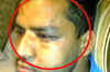 Three Indians attacked by 70 locals in Australia