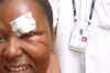 First pictures of Ugandan officials injured at CWG